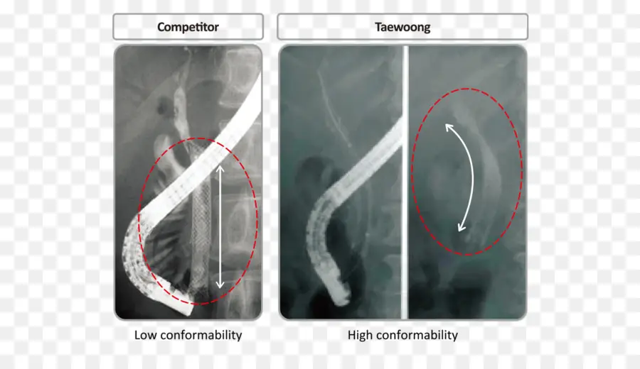 การเปรียบเทียบ X Ray，ความสอดคล้อง PNG