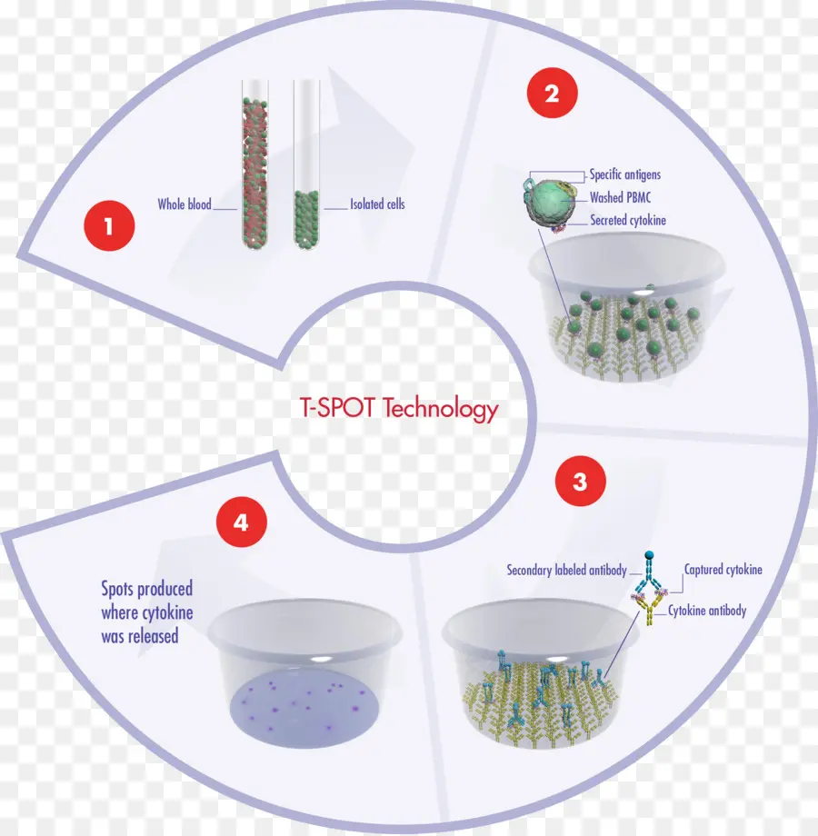 เทคโนโลยี T Spot，การตรวจเลือด PNG
