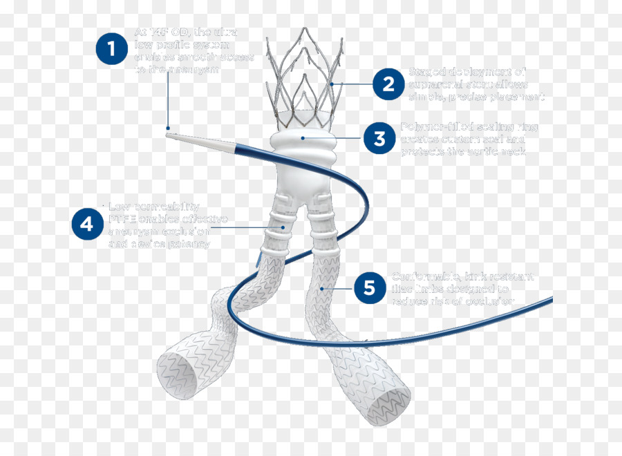 เส้นเลือดโป่งพอง，ในช่องท้อง Aorta PNG