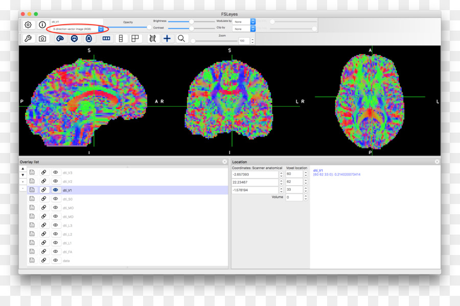 Diffusion รวจดูภาพสแกนสมอง，สเกลา PNG