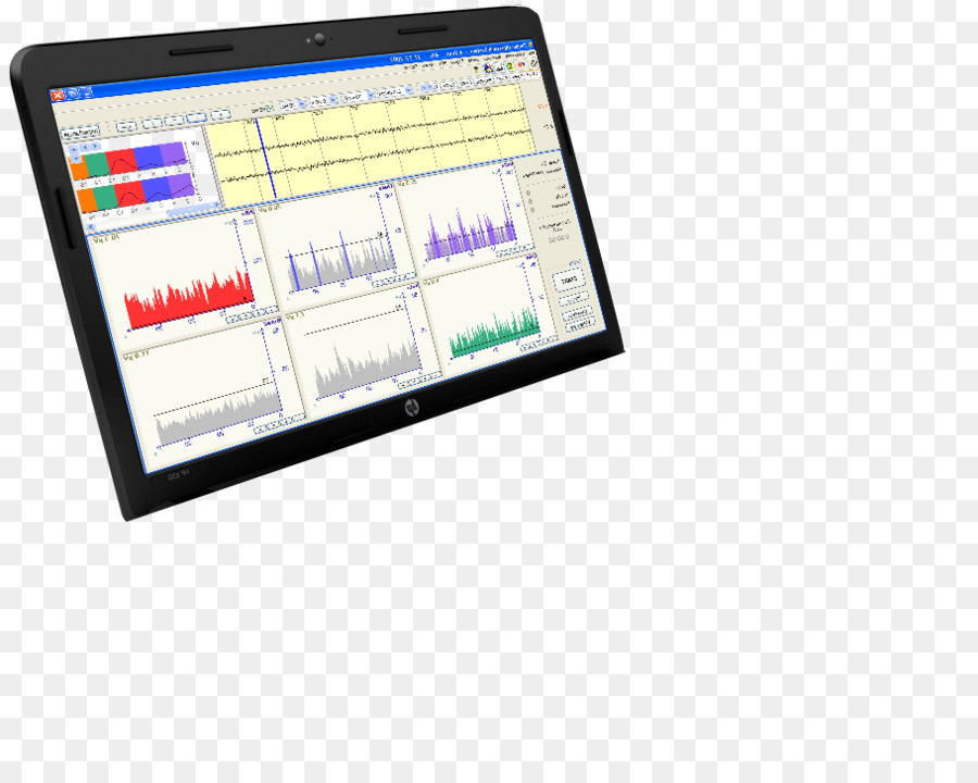 Neurofeedback，อุปกรณ์แสดงผล PNG