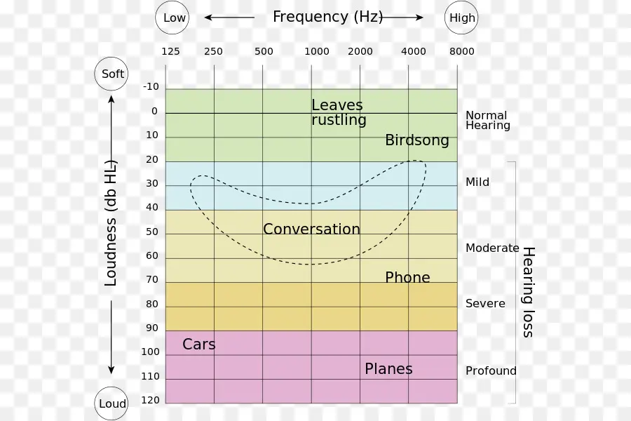 แผนภูมิการสูญเสียการได้ยิน，ความถี่ PNG