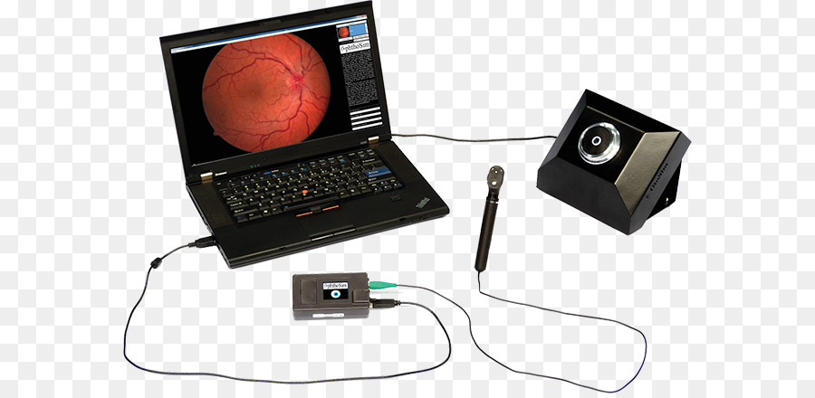 Ophthalmoscopy，ระบบจำลอง PNG