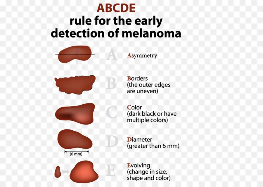 การตรวจจับ Melanoma，ผิว PNG