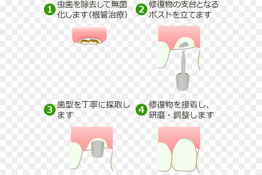 ทางตะวันตก Japan Kgm Fu รา ワ ー ฟันของคัดลอกโรงพยาบาล Waseda ยะแหยงพื้นที่ตะวันออก Japan Kgm，หมอฟัน PNG