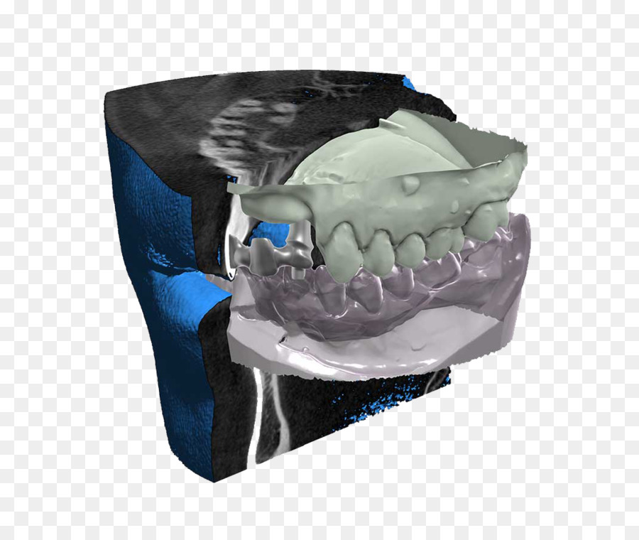 Cadcam，Dicom PNG