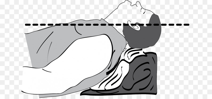 Tracheal สอดท่อช่วยหายใจ，ใช้พลาสติคเพื่อลดความดัการจัดการ PNG