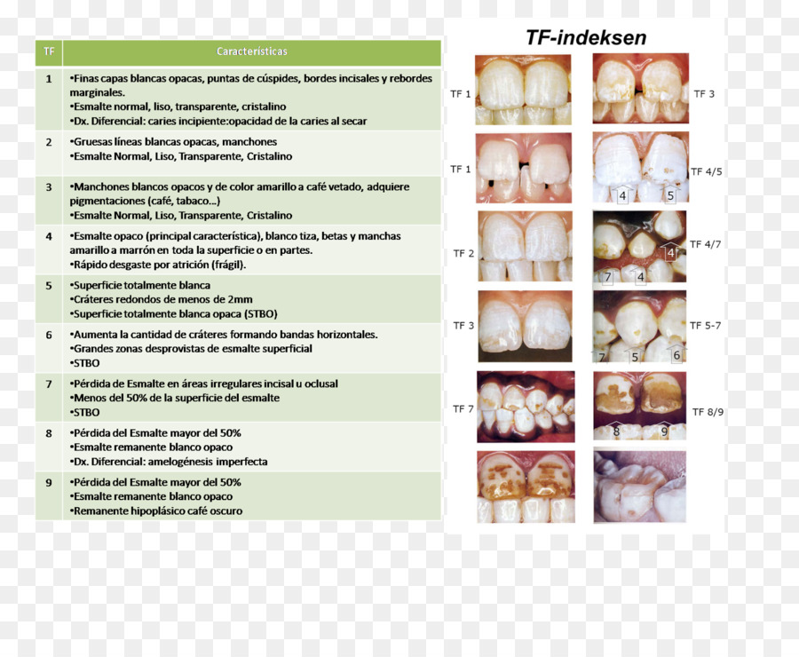 สื่อไม่สนเรื่อ，ฟันของ Fluorosis PNG