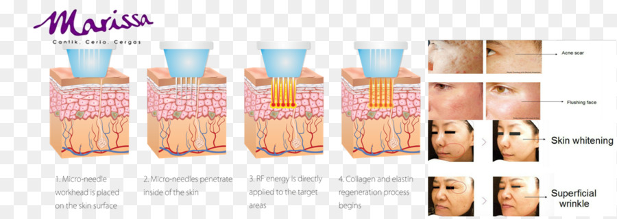 เครื่องสำอางค์，ผิวหนัง PNG