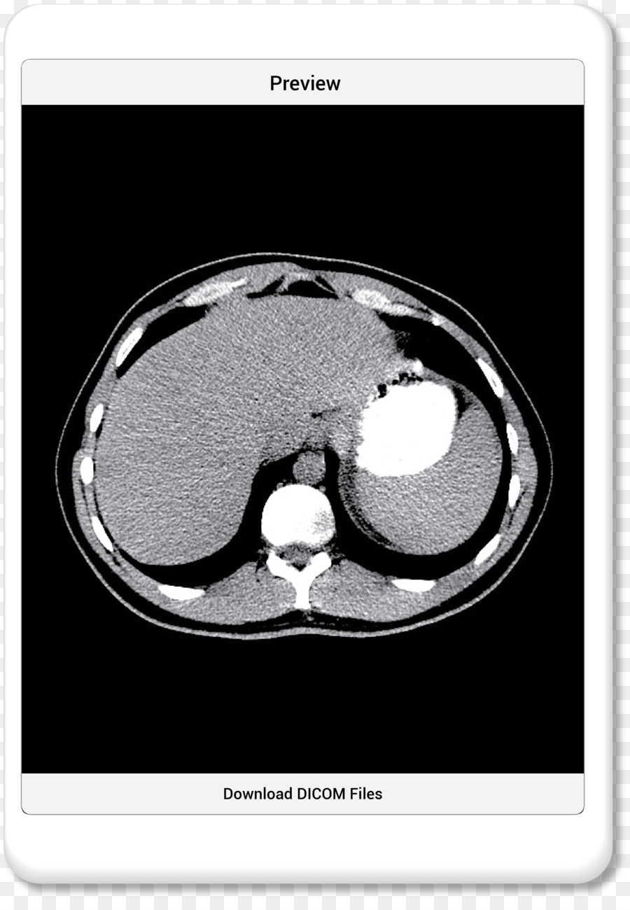 การถ่ายภาพทางการแพทย์，ส่วนที่คำนวณแล้ว Tomography PNG