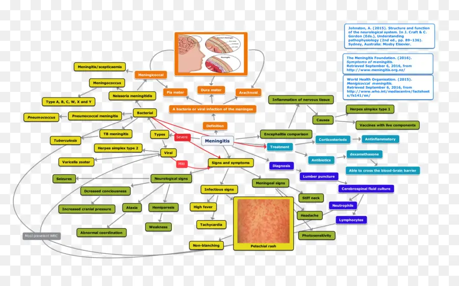 ไดอะแกรมเยื่อหุ้มสมองอักเสบ，ทางการแพทย์ PNG